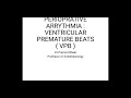 Perioprative arrythmia  ventricular premature beats  vpb 