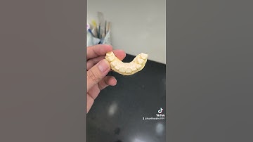 Bọc răng sứ 2 răng cửa 11 21 #shorts #rangsuthammy #bocrangsu