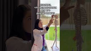 СКОЛИОЗ - ЧТО ЭТО? ЧТО НУЖНО ,ЧТОБЫ ОПРЕДЕЛИТЬ И ПОСТАВИТЬ ДИАГНОЗ? #scoliosis