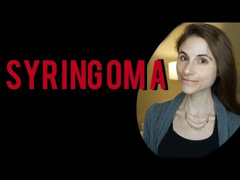 Syringoma treatments| Q&A with dermatologist Dr Dray