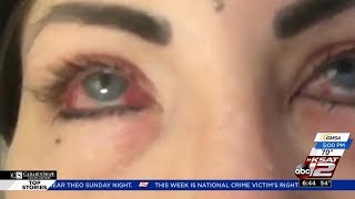 BRIGHTOCULAR GONE WRONG - WOMAN 50% BLIND AFTER BRIGHTOCULAR PROCEDURE