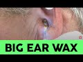 Ear Wax Double Feature!