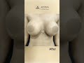 Enhance The Size And Shape Of Breast With Breast Implant Surgery Breast Breastimplant Shorts Enhance The Size And Shape Of Breast With Breast Implant Surgery Breast Breastimplant Shorts