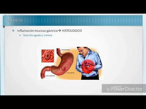 GASTRITIS