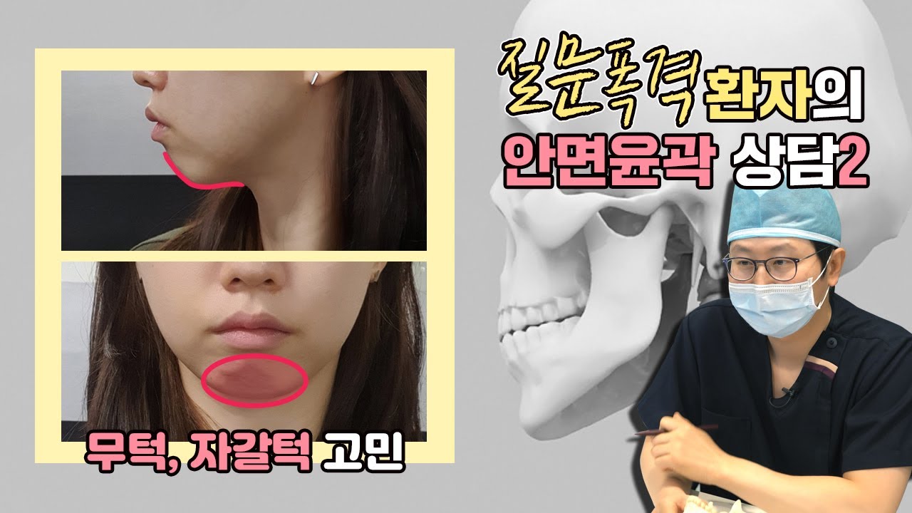 무턱, 자갈턱이 고민인 환자분의 질문폭격 상담영상2편 — 유튜브 영상 썸네일