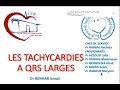 Les tachycardies  qrs  larges chu ibn roccasablanca  acir