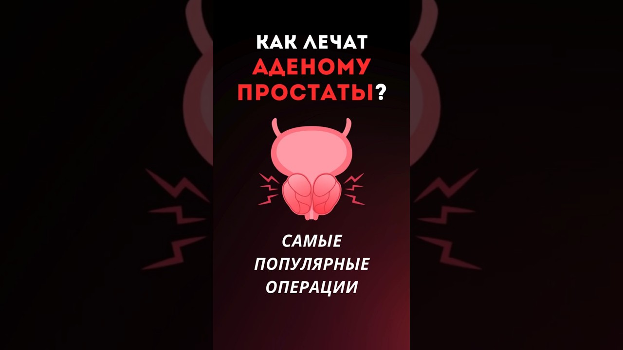 АДЕНОМА ПРОСТАТЫ - самые популярные операции #здоровье #медицина #уролог #простата