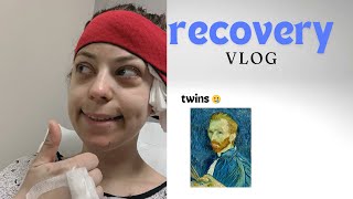 POST SURGERY VLOG