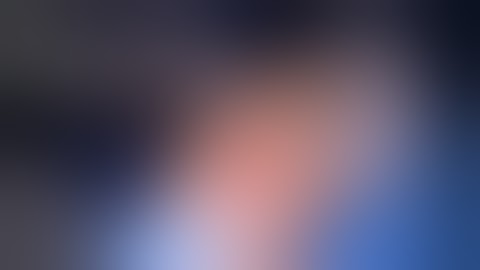 IBSN dissection - Infrapatellar branch of saphenous nerve