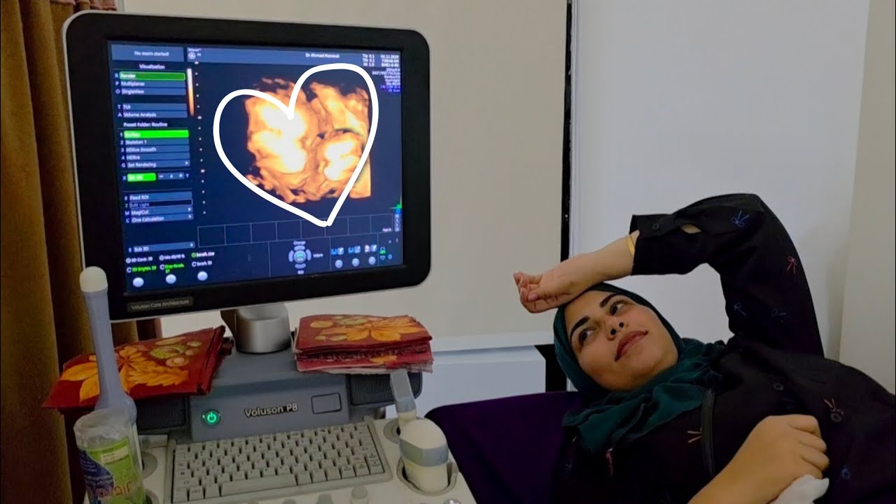 لولولولي اخييييرا🥳روحنا كلنا للدكتور علشان نطمن علي البيبيهات🤫خلاص هانت وهولد💃