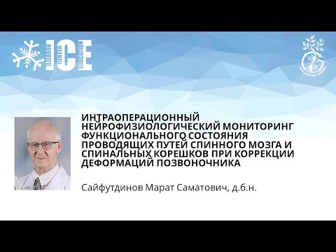 НЕЙРОМОНИТОРИНГ СОСТОЯНИЯ ПРОВОДЯЩИХ ПУТЕЙ СПИННОГО МОЗГА  ПРИ КОРРЕКЦИИ ДЕФОРМАЦИЙ ПОЗВОНОЧНИКА"