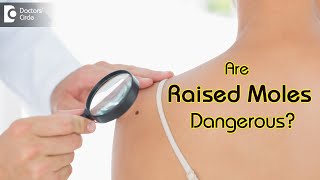 Know Your Moles Well |Are raised moles bad? Types & Danger Signs-Dr. Renuka Shetty | Doctors' Circle