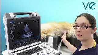 How to perform TAPSE