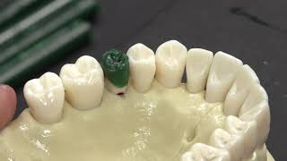 Celebrity Waxing Tooth #4 Pre Molar Waxing | Dental School | Pre-Dental | INBDE | Dental Anatomy | Wax Profile