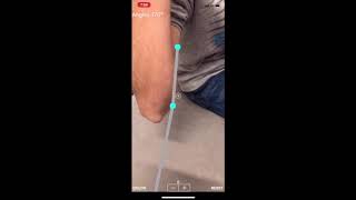 (AR )Augmented Reality orthopaedic  Goniometer. How to measure with the App ARorthopaedicGoniometer screenshot 5