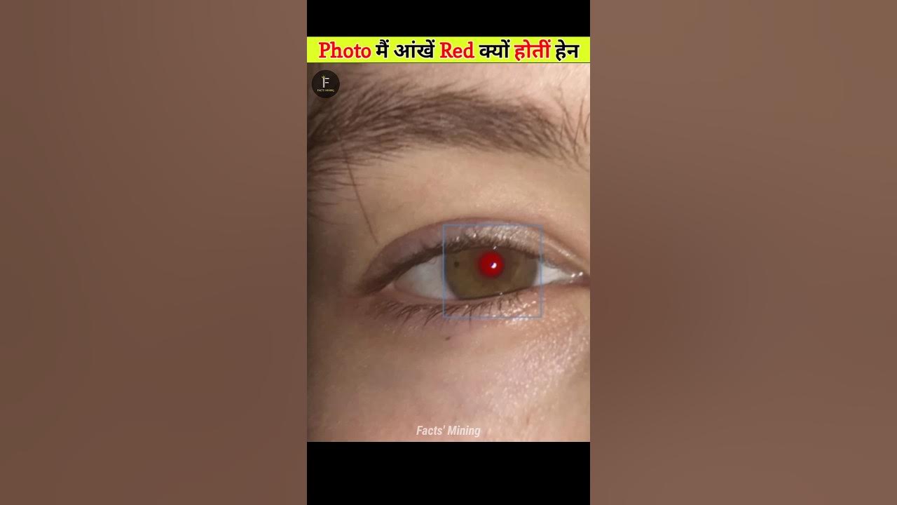 Why Do Eyes Turn Red IN Photos? YouTube
