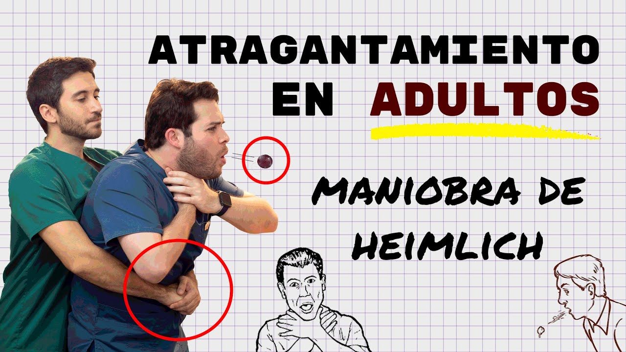 Atragantamiento en adultos ¿Qué hacer? | Doctor Negrete