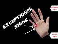 Special signs on Mercury mount Palmistry - Star Triangle Square on Mercury mount