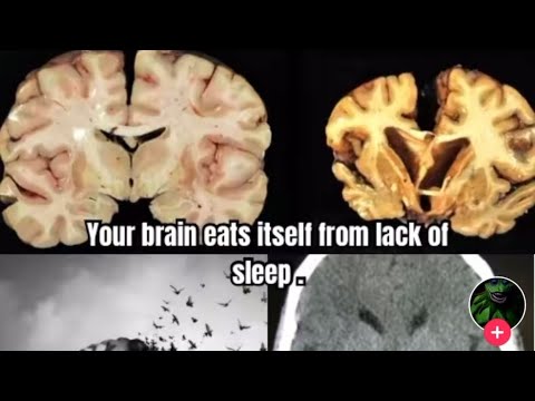 Do Not Let Your Brain “Eat” Itself… 😰