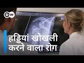 हड्डियां खोखली होती जाती हैं और पता भी नहीं चलता [Osteoporosis: Why do bones become brittle?]