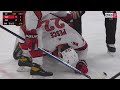 NHL: Injuries 2021 Part 3