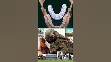 Bí Ẩn Người TÍ HON và Người KHỔNG LỒ P93 - Có Thể Bạn Chưa Biết | Thế Giới Bí Ẩn #shorts #short