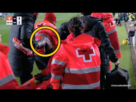 Doctor Reacts to Mouctar Diakhaby Horrible Knee Injury and Replay