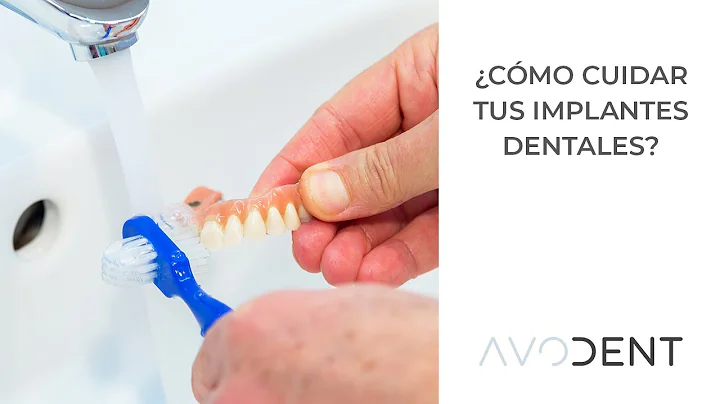 Cmo cuidar tus implantes dentales? | Doctora Claud...