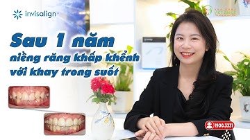 Niềng răng khay trong suốt invisalign khắc phục răng khấp khểnh được không? - KH - H.T. Trang HN5187