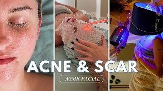ASMR Acne and Scar Lightening Facial Treatment + Guided Meditation  Jadeywadey180