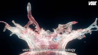 Vogt New Head Office - Reasons For The Change