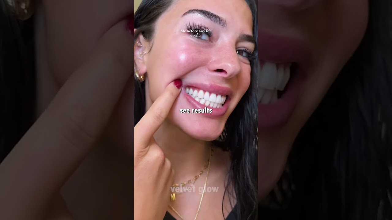 Do Teeth Whitening Strips Actually Work 🦷✨