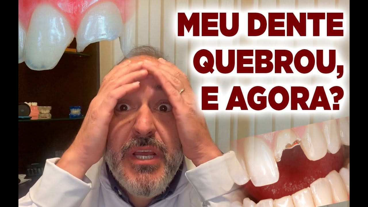 Fiz Restauração é Meu Dente Dói Quando Bebo água Gelada MEU DENTE QUEBROU, E AGORA? Dicas urgentes. - YouTube