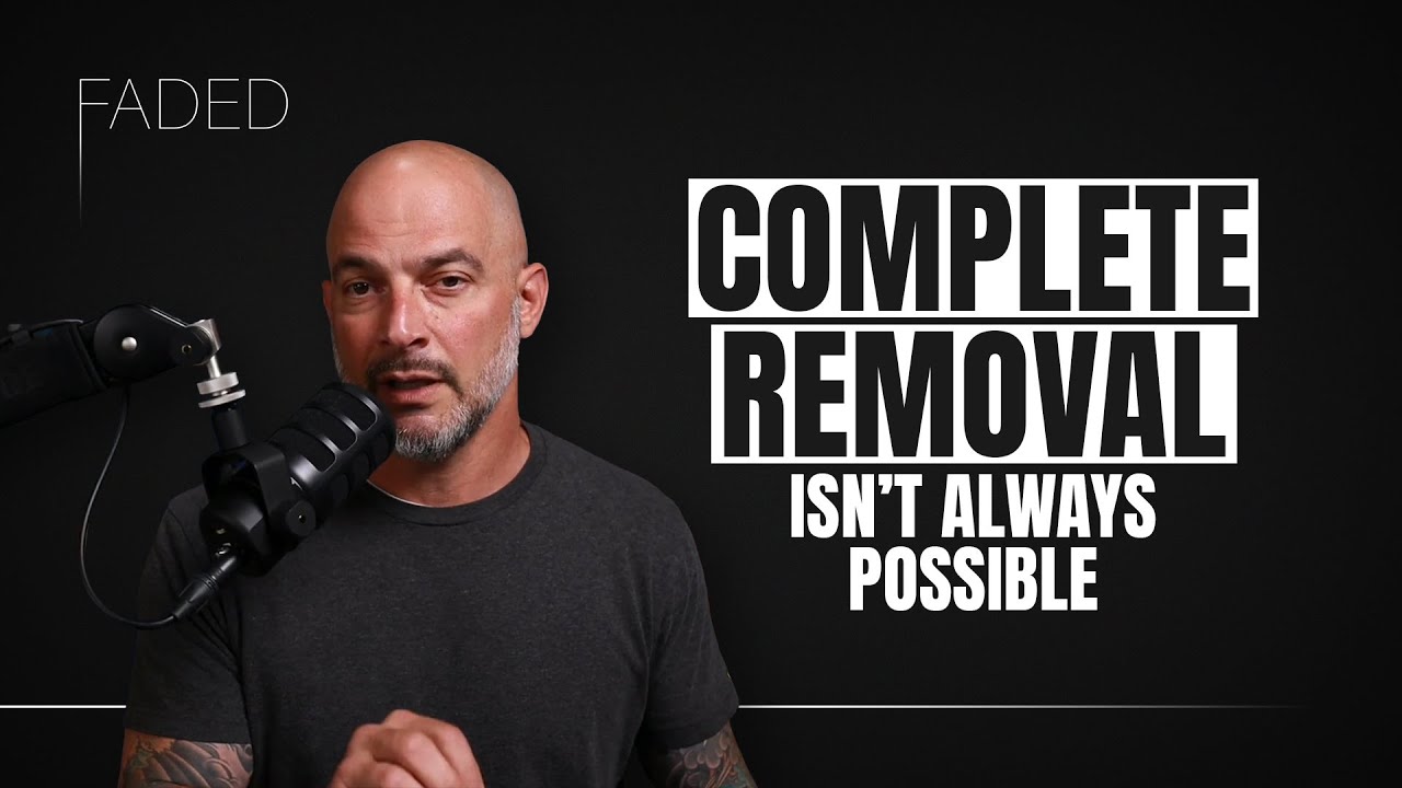 How Laser Tattoo Removal Works