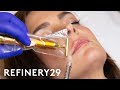 The Truth Behind Instagram-Famous Plastic Surgeons | Shady | Refinery29