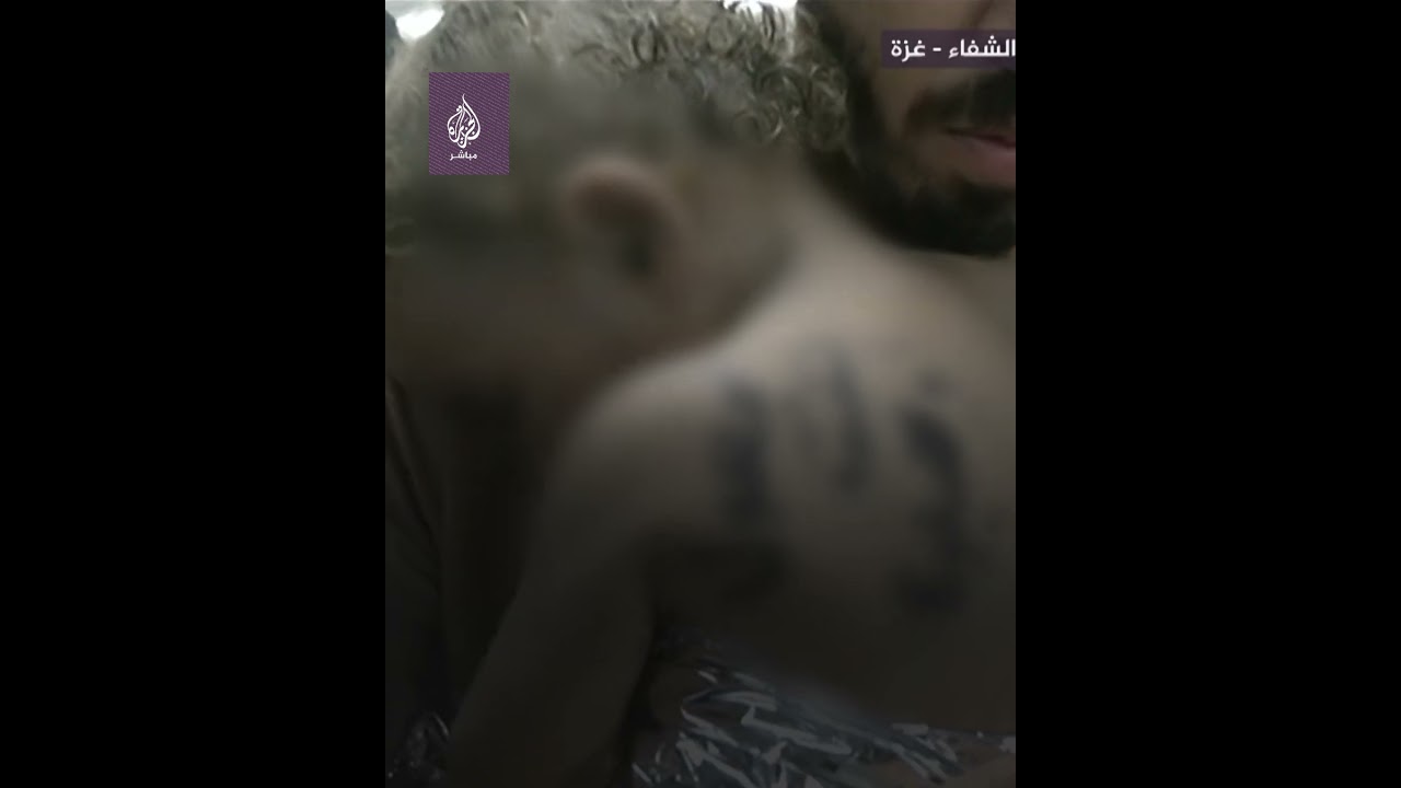 مسعف يحتضن طفلة مصابة لتهدئتها بعد نجاتها من قـ ـصـ ـف الاحتلال