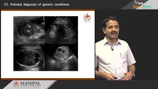 Prenatal diagnosis of genetic conditions