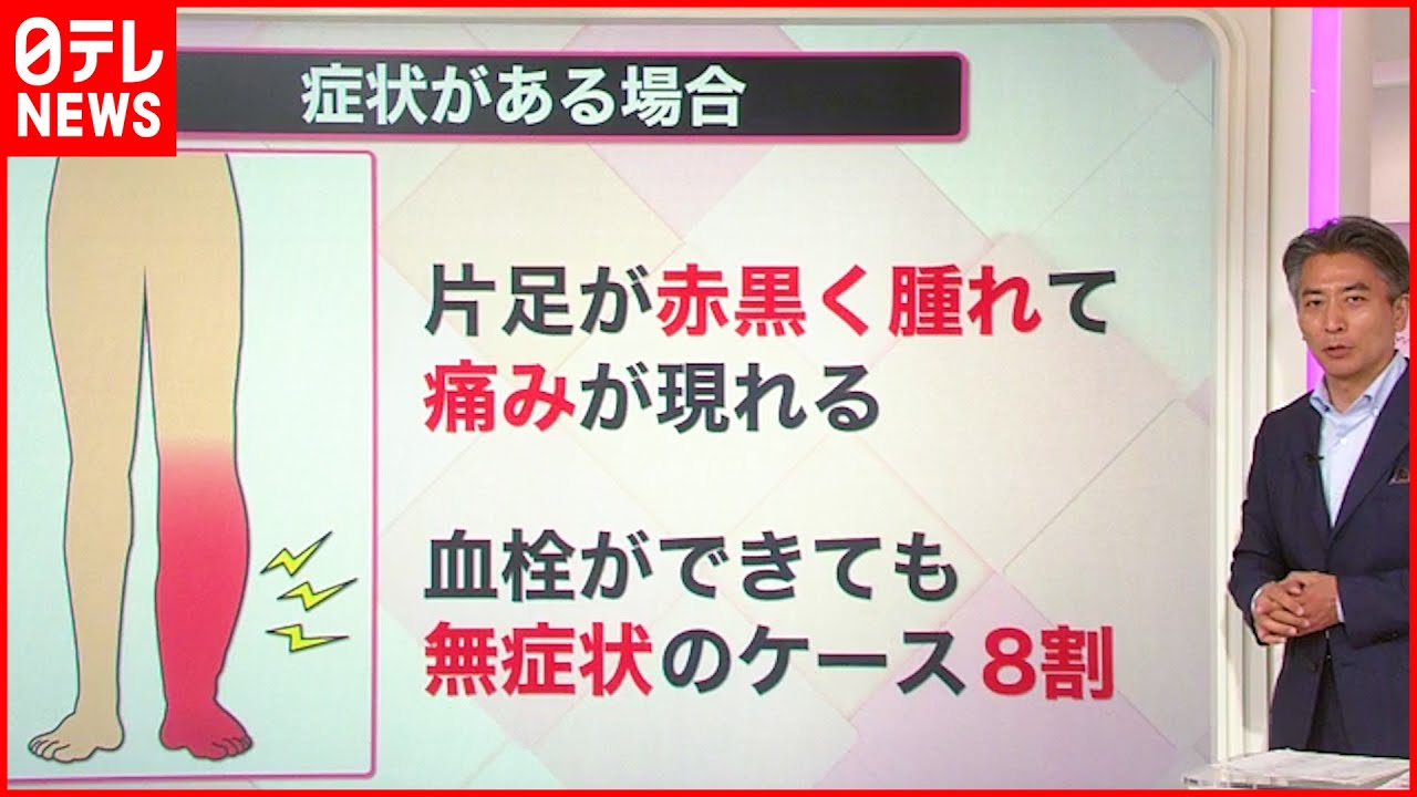 静脈血栓症の症状