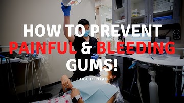 Do Your Gums Bleed When You Floss? / Dental Deep Cleaning Near Me / Dentist in Houston