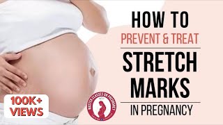 How to prevent and treat Stretch Marks in pregnancy| Dr Anjali Kumar | Maitri