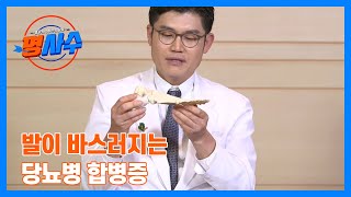 뼈가 무너져도 모른다 발 바스러지는 당뇨병 합병증! MBN 230412 방송