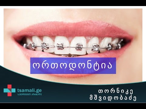ორთოდონტია - საუბრობს თორნიკე მშვიდობაძე