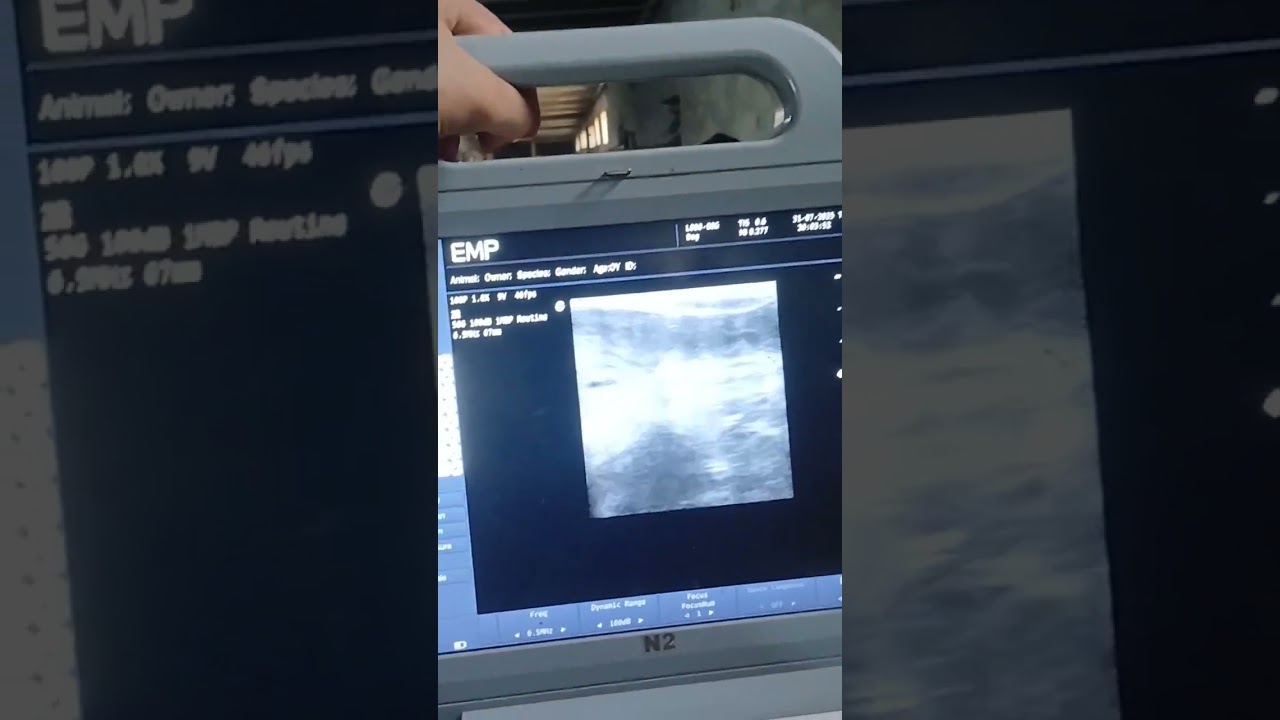 #ultrasound
