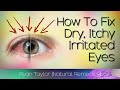 How To Cure Dry Eyes Fast (Natural Remedies)