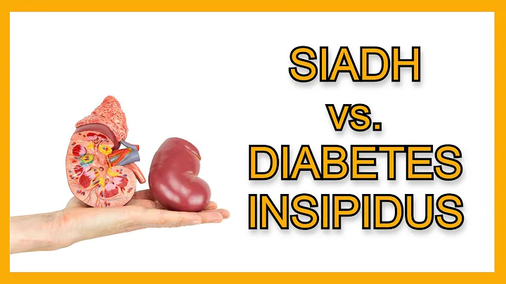 SIADH vs. Diabetes Insipidus