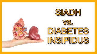 SIADH vs. Diabetes Insipidus