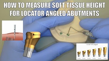 How to Measure Soft Tissue Height for LOCATOR Angled Abutments