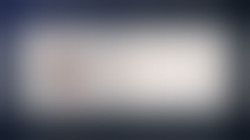 Thrombotic, Dolichoectatic, Distal PCA Aneurysm Treated with Excision and P2-P2 Reanastomosis