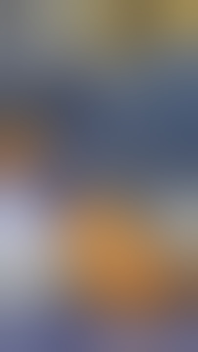 Silicone gel implants   inverted nipple repair  #breastaugmentation #plasticsurgery #plasticsurgeon