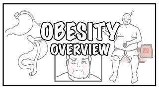 Approach to OBESITY and Weight gain  causes, risk factors, BMI, complications and treatment